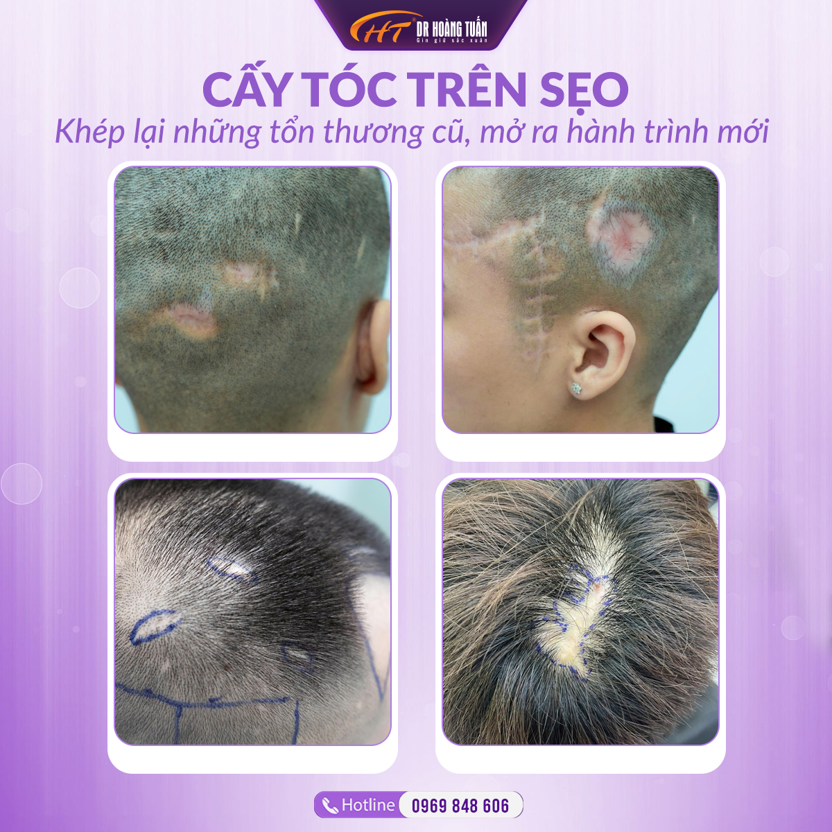 Bản tin tuần Dr Ho&agrave;ng Tuấn số 20 - tuần 4 th&aacute;ng 10