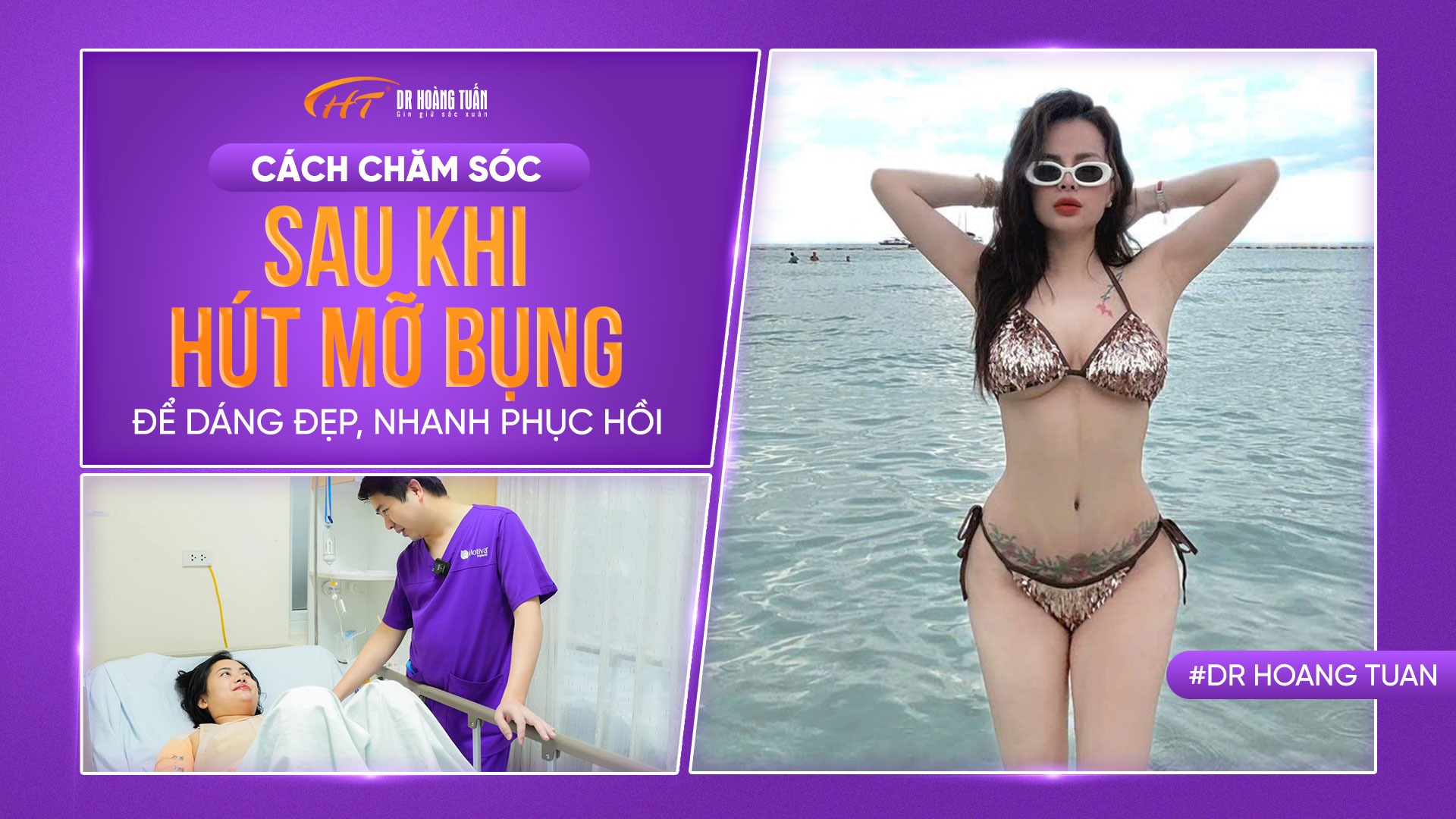 C&aacute;ch chăm s&oacute;c sau khi h&uacute;t mỡ bụng để d&aacute;ng đẹp, nhanh phục hồi