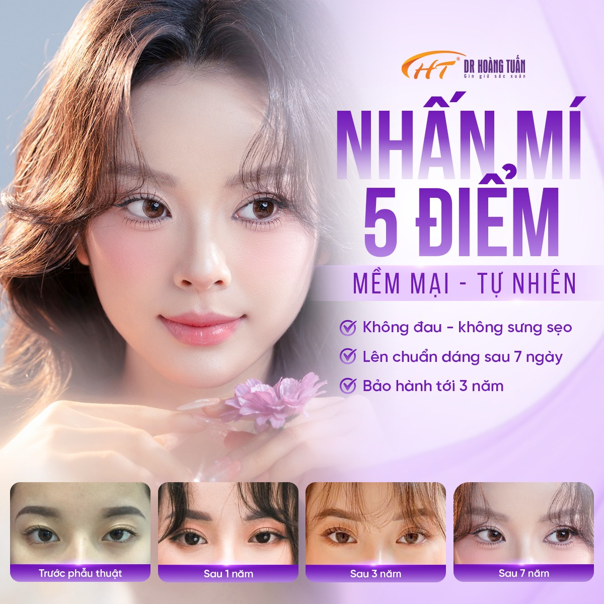 Cắt mí hay nhấn mí tốt hơn? Bác sĩ phân tích để bạn chọn đúng ngay lần đầu