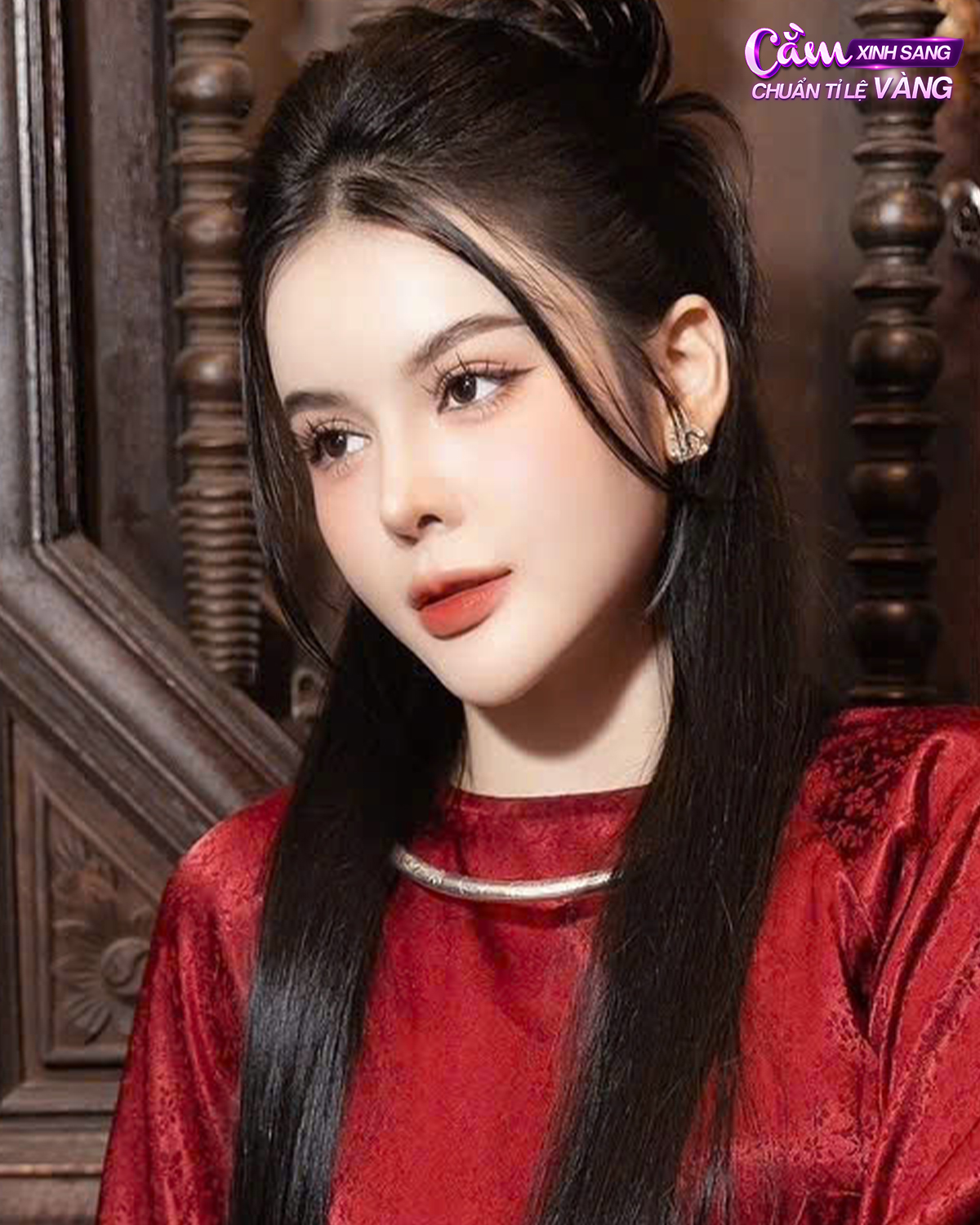 Độn cằm giữ được bao lâu? Sự thật bác sĩ muốn bạn biết trước khi quyết định