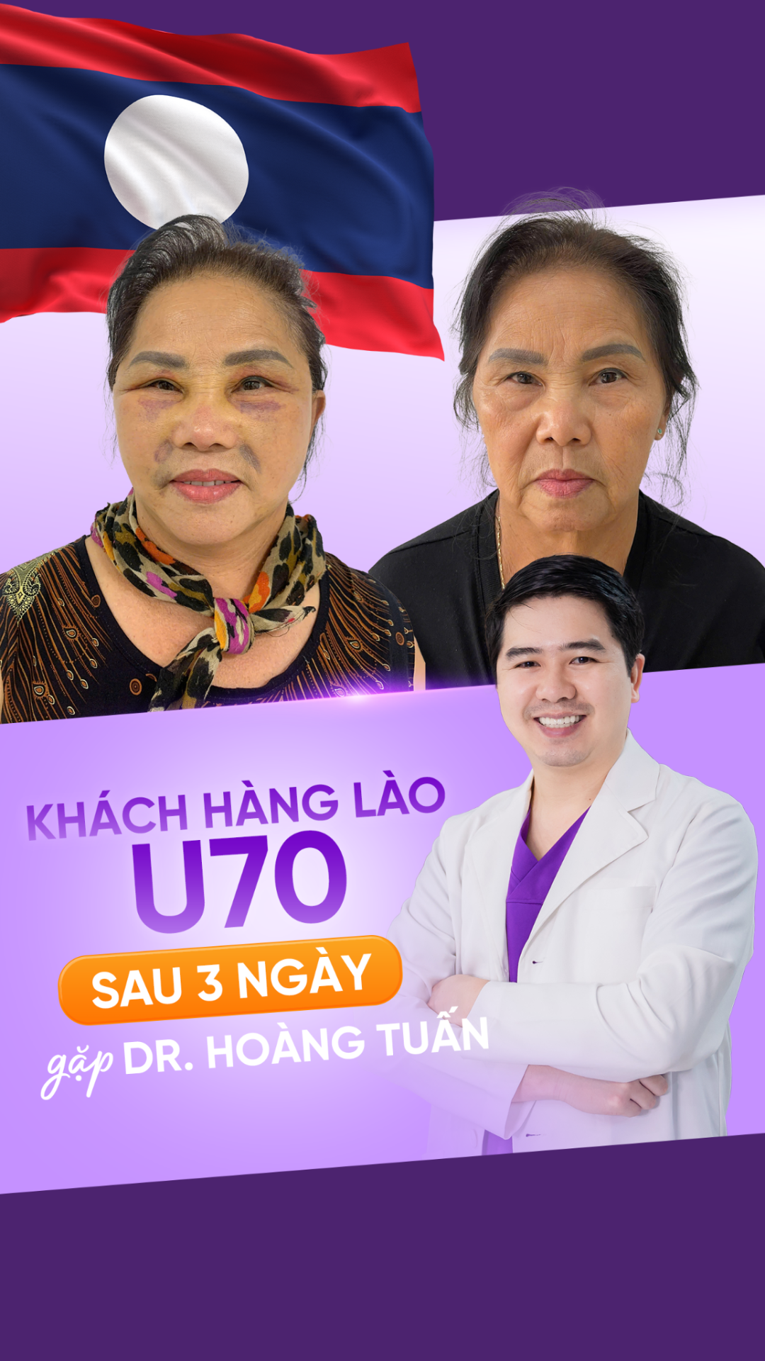 Dr. Ho&agrave;ng Tuấn


kh&aacute;ch h&agrave;ng L&agrave;o U70


trẻ h&oacute;a sau 3 ng&agrave;y


l&agrave;m đẹp xuy&ecirc;n bi&ecirc;n giới


thẩm mỹ Việt Nam vươn tầm quốc tế

