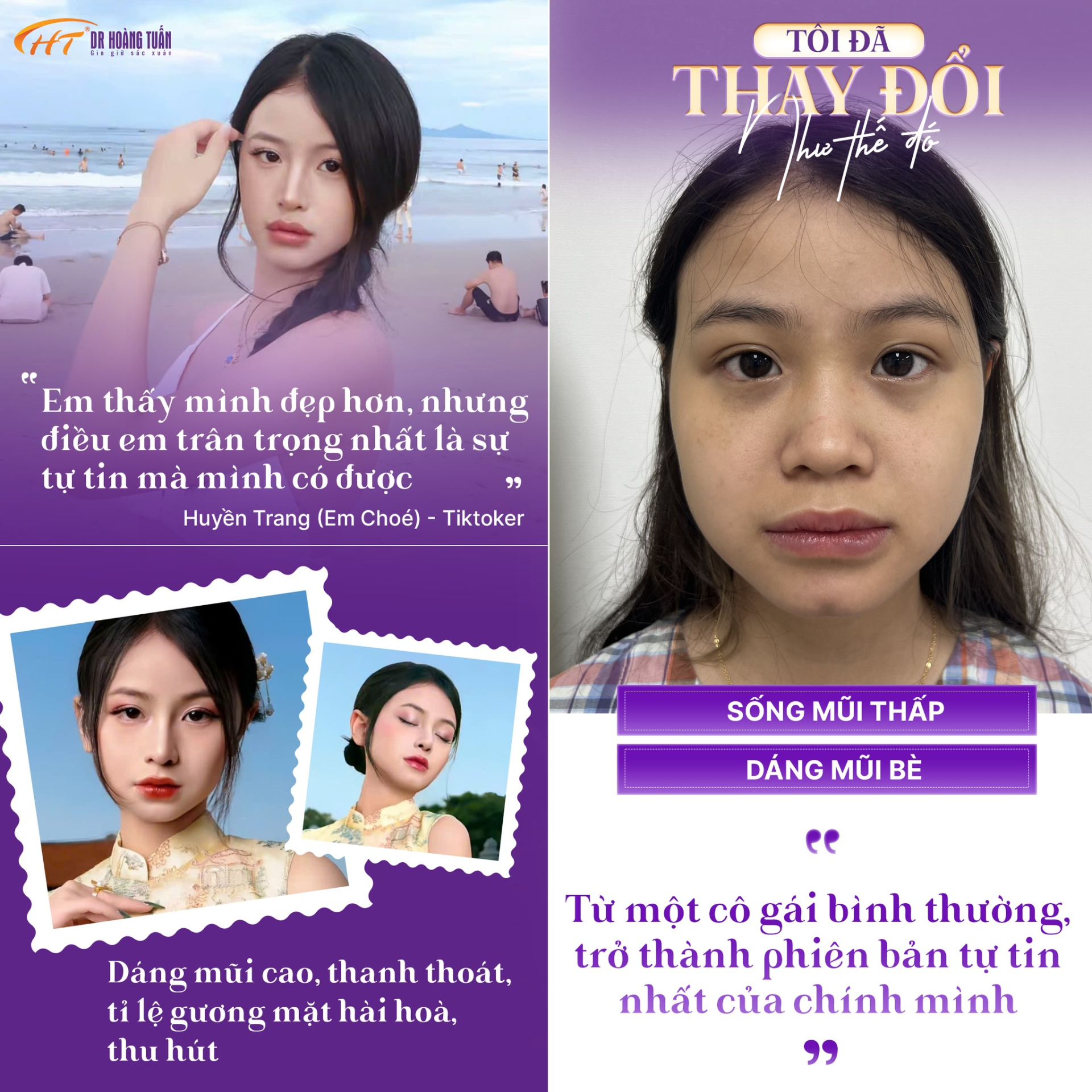 DR. Ho&agrave;ng Tuấn
Thẩm mỹ Ho&agrave;ng Tuấn
N&acirc;ng mũi Pureform