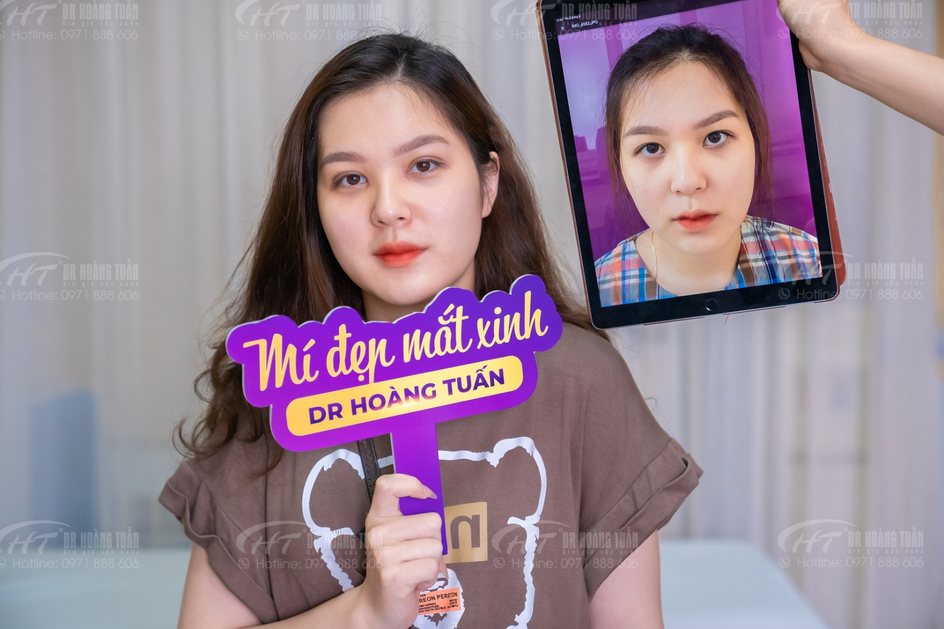 Mở góc mắt có đau không? Giải đáp từ chuyên gia Thẩm Mỹ Mắt Dr Hoàng Tuấn