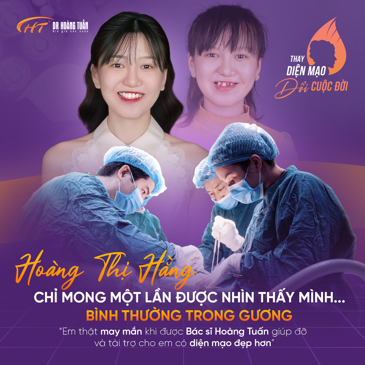 Người b&igrave;nh thường
Khiếm khuyết bẩm sinh
Nụ cười