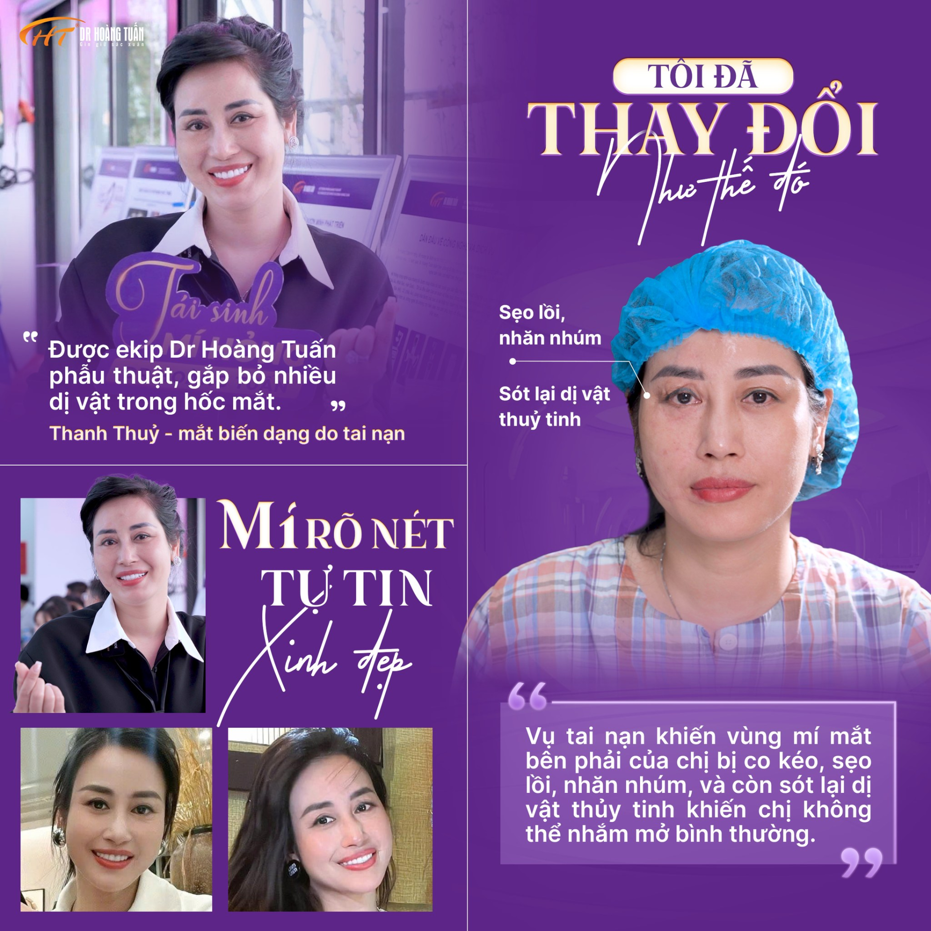 Tôi đã thay đổi như thế đó