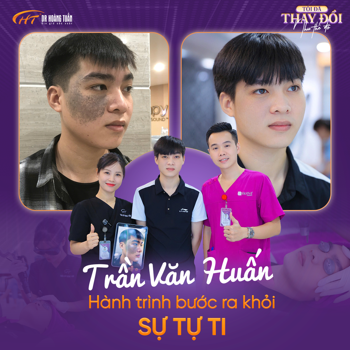 Trần Văn Huấn
thay đổi ngoại h&igrave;nh
bớt bẩm sinh
Dr Ho&agrave;ng Tuấn
Ho&agrave;ng Thanh Tuấn