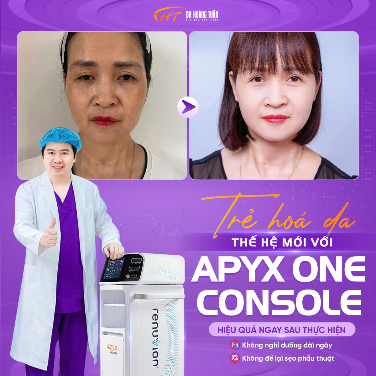 Trẻ ho&aacute; khu&ocirc;n mặt to&agrave;n diện với c&ocirc;ng nghệ hiện đại đến từ Hoa Kỳ - Apyx One Console