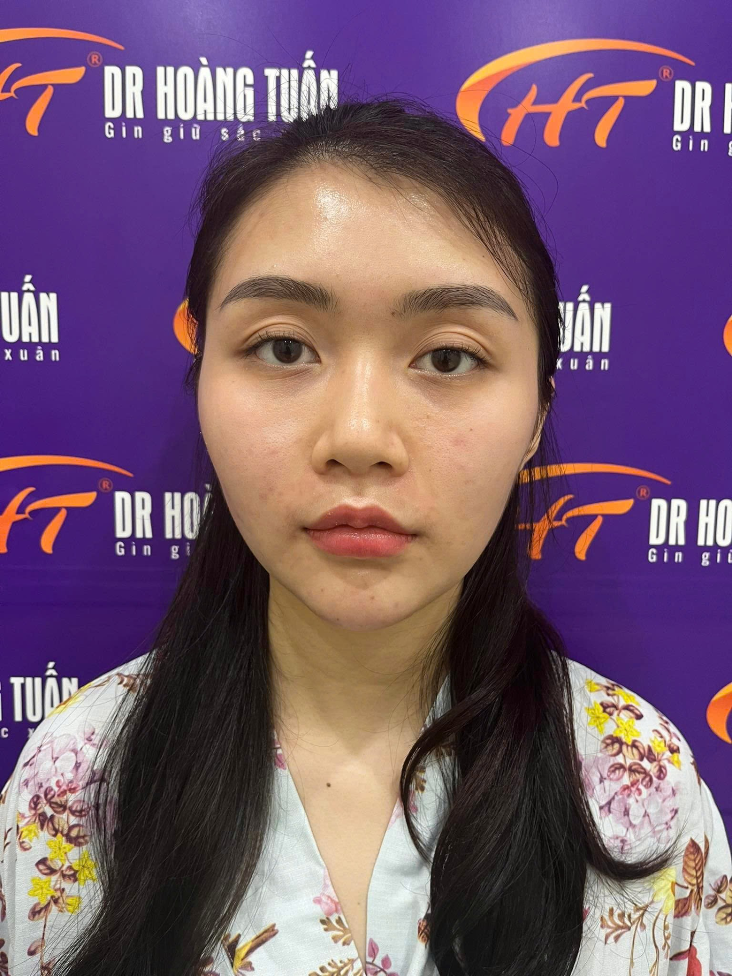 Thẩm mỹ Ho&agrave;ng TuấnDr. Ho&agrave;ng Tuấn