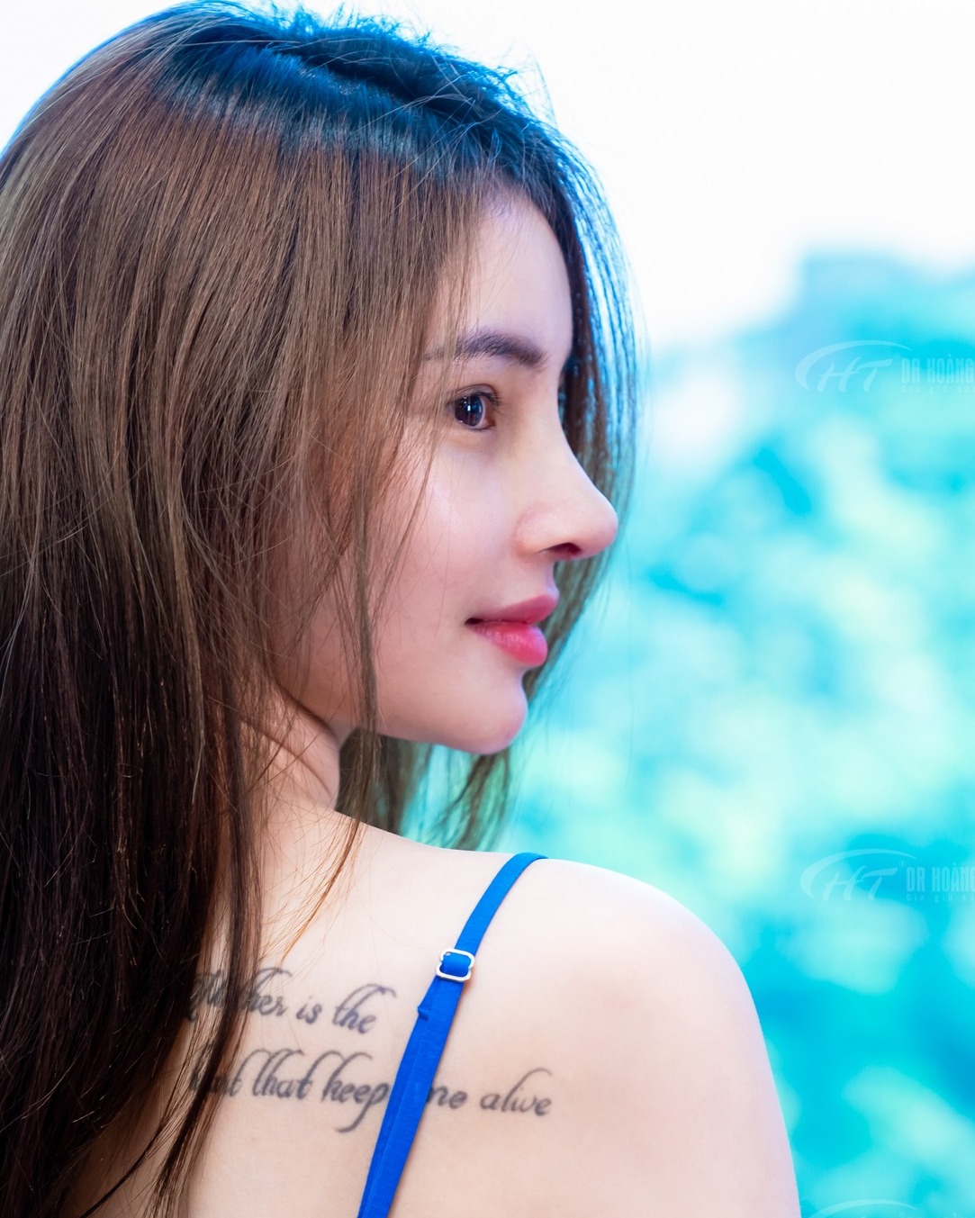 nâng mũi sụn sườn là gì