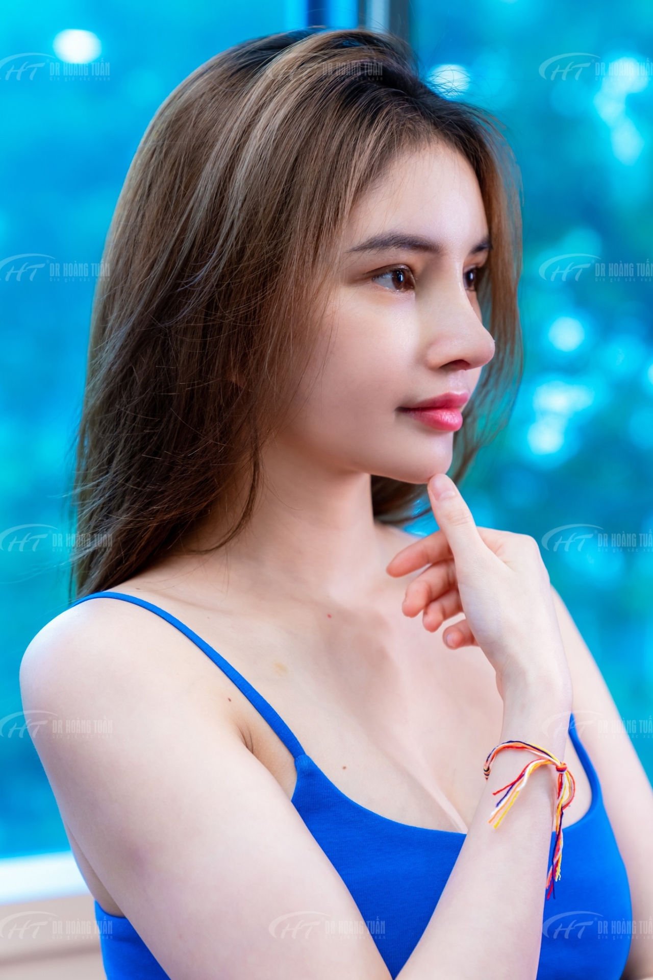 nâng mũi sụn sườn là gì