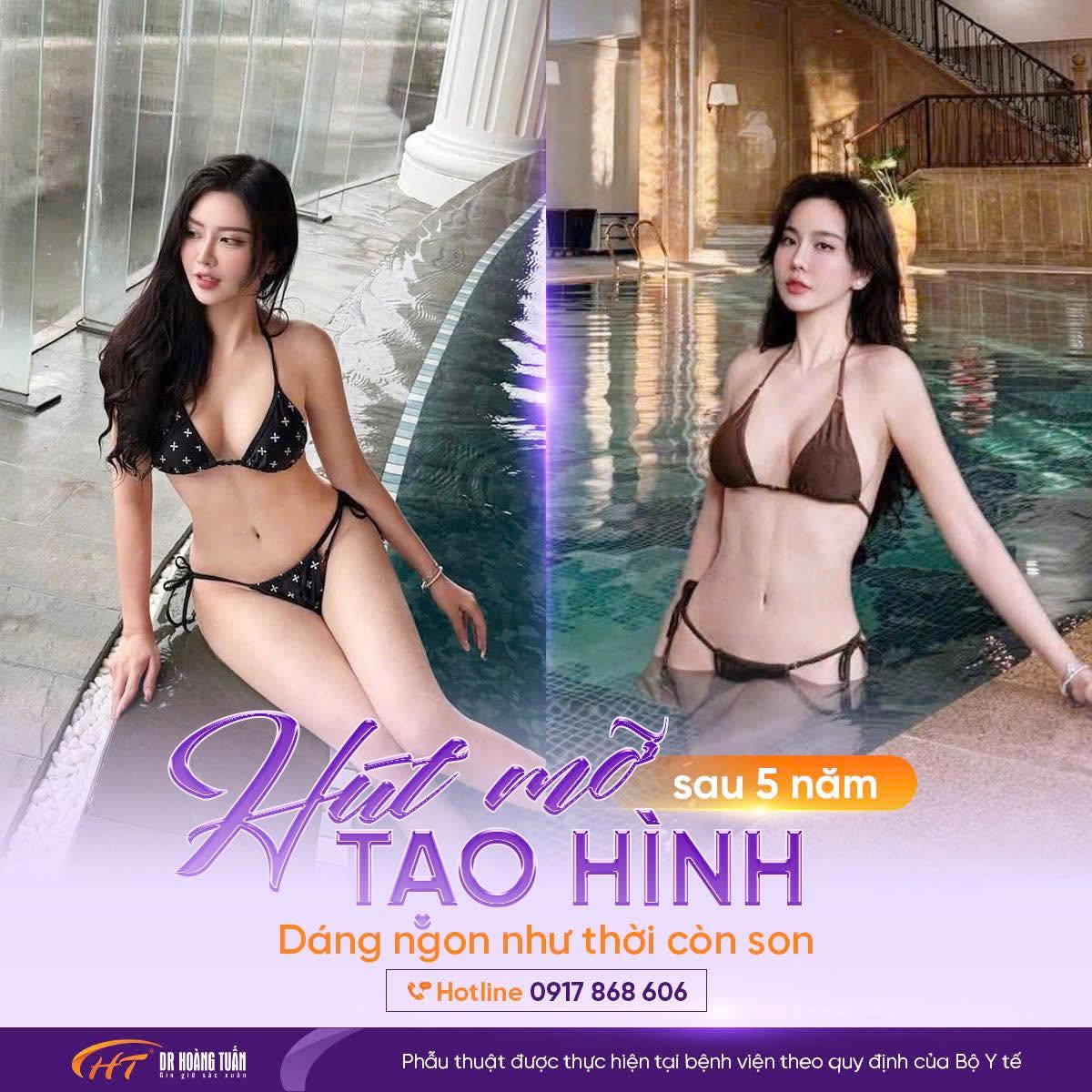 Dr Hoàng Tuấn - địa chỉ hút mỡ toàn thân chuẩn y khoa