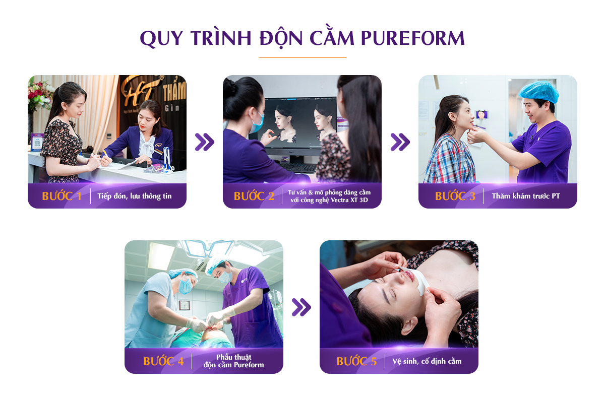 Quy trình độn cằm Pureform tuân thủ đúng quy định Bộ Y Tế