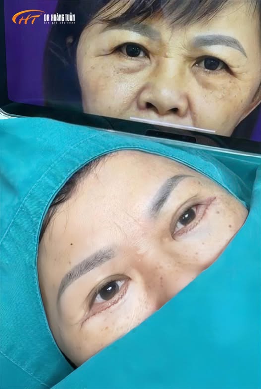 cắt m&iacute; dưới ở đ&acirc;u đẹp