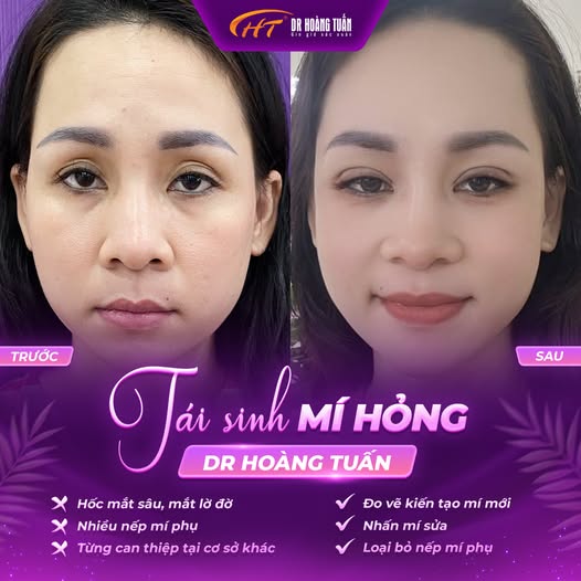 cắt m&iacute; qu&aacute; to c&oacute; sửa được kh&ocirc;ng