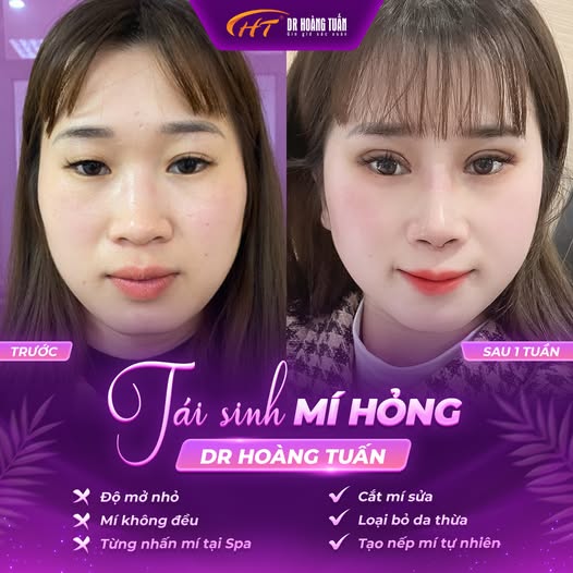 cắt m&iacute; qu&aacute; to c&oacute; sửa được kh&ocirc;ng
