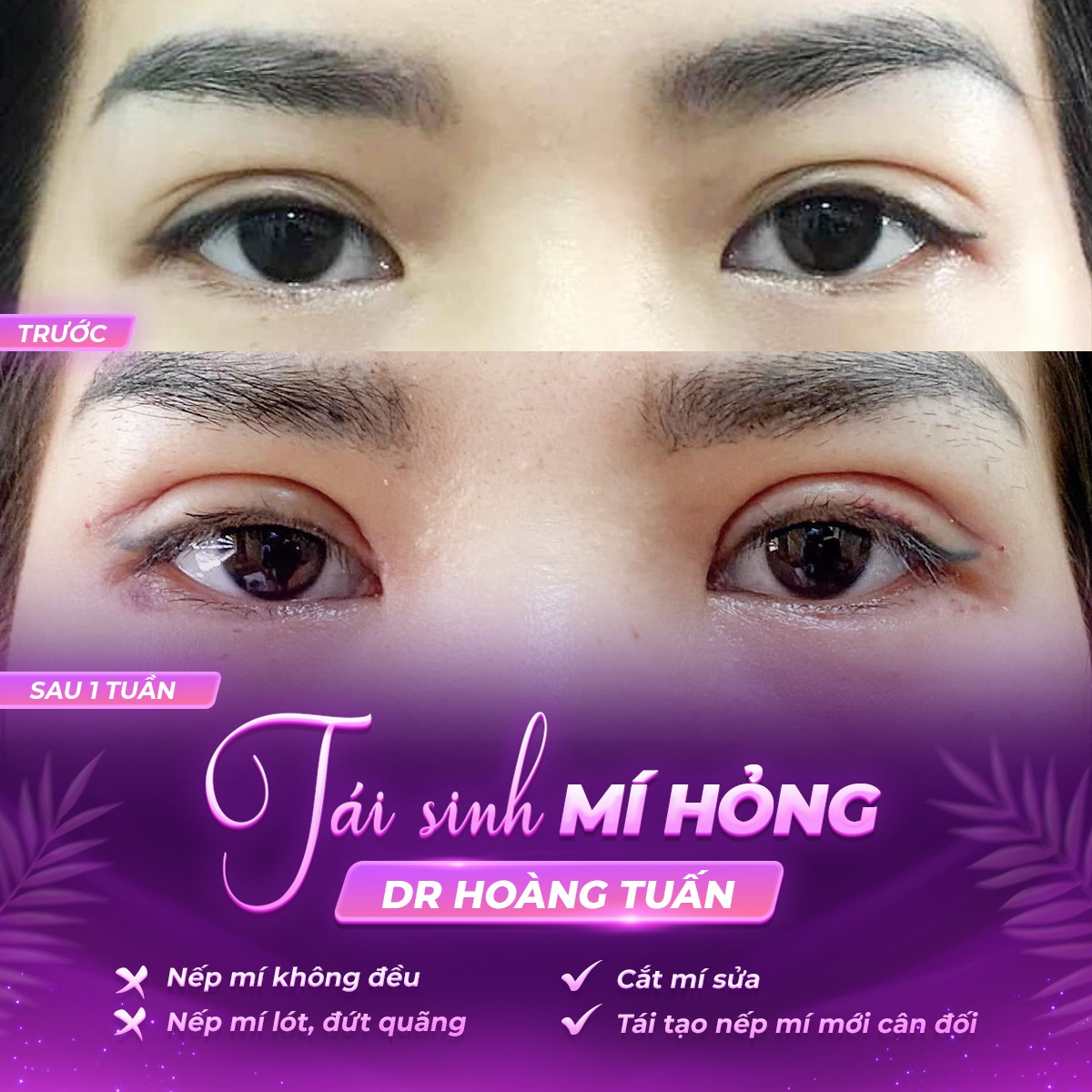 cắt m&iacute; l&oacute;t