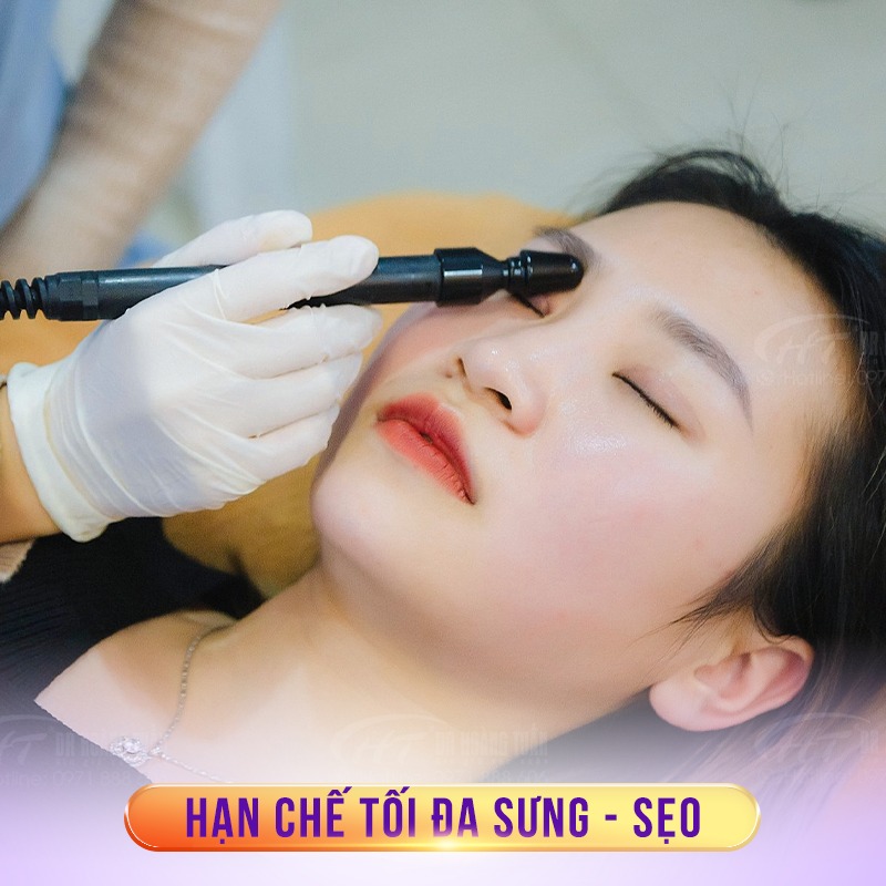 cắt mí có đau không