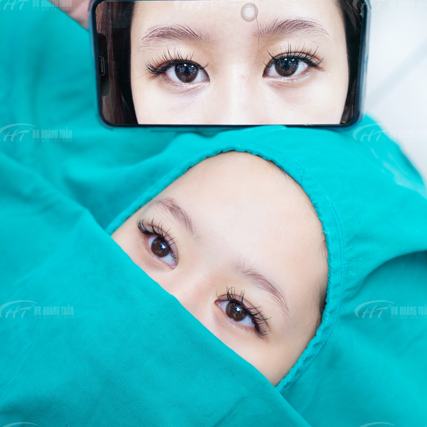 cắt m&iacute; ki&ecirc;ng nếp bao l&acirc;u