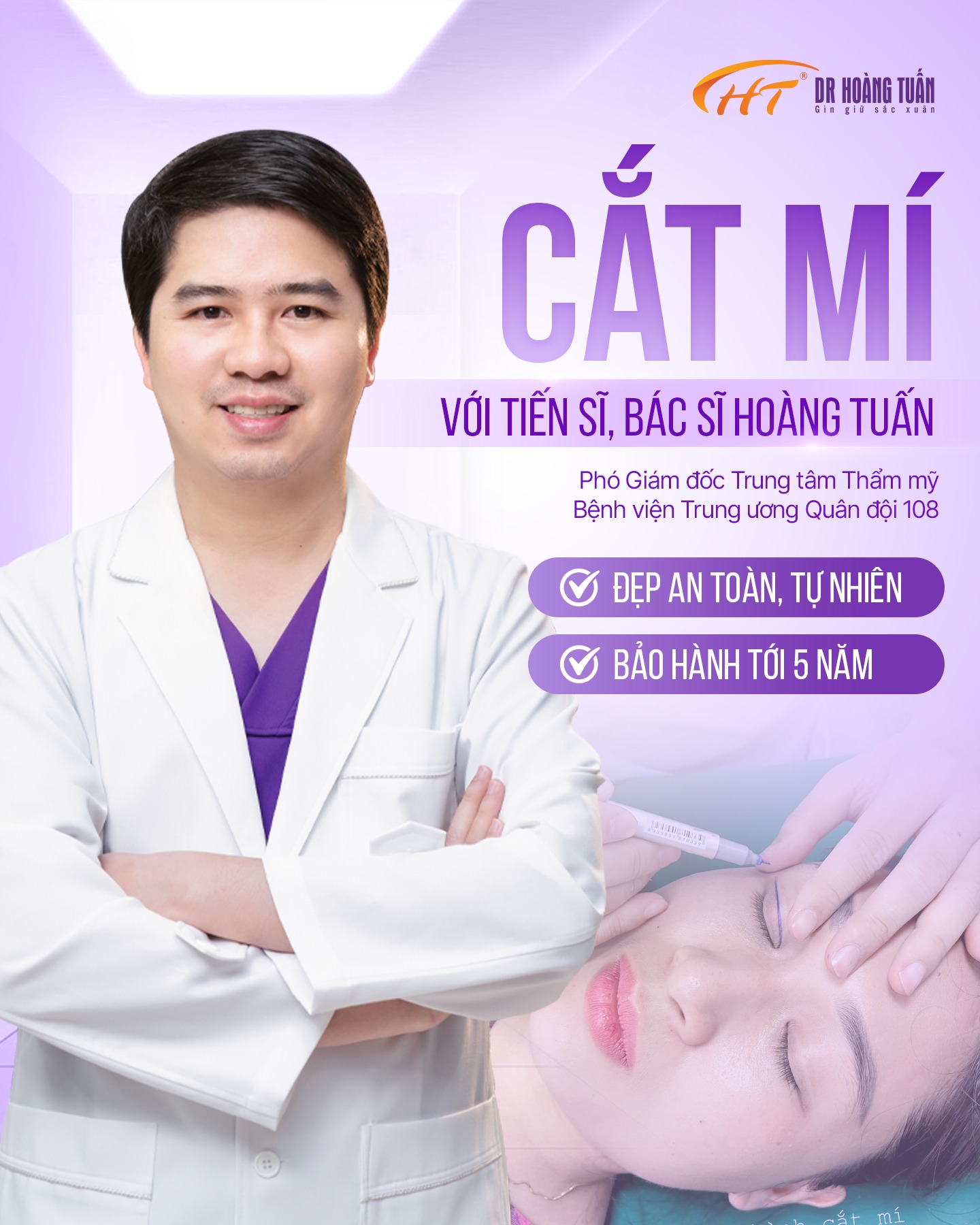 cắt mí mắt không đều