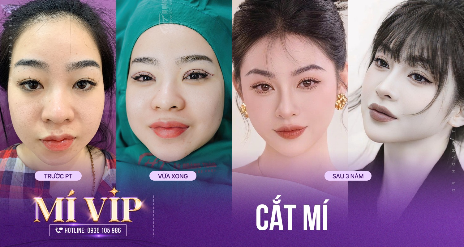 cắt m&iacute; c&oacute; giữ được vĩnh viễn kh&ocirc;ng