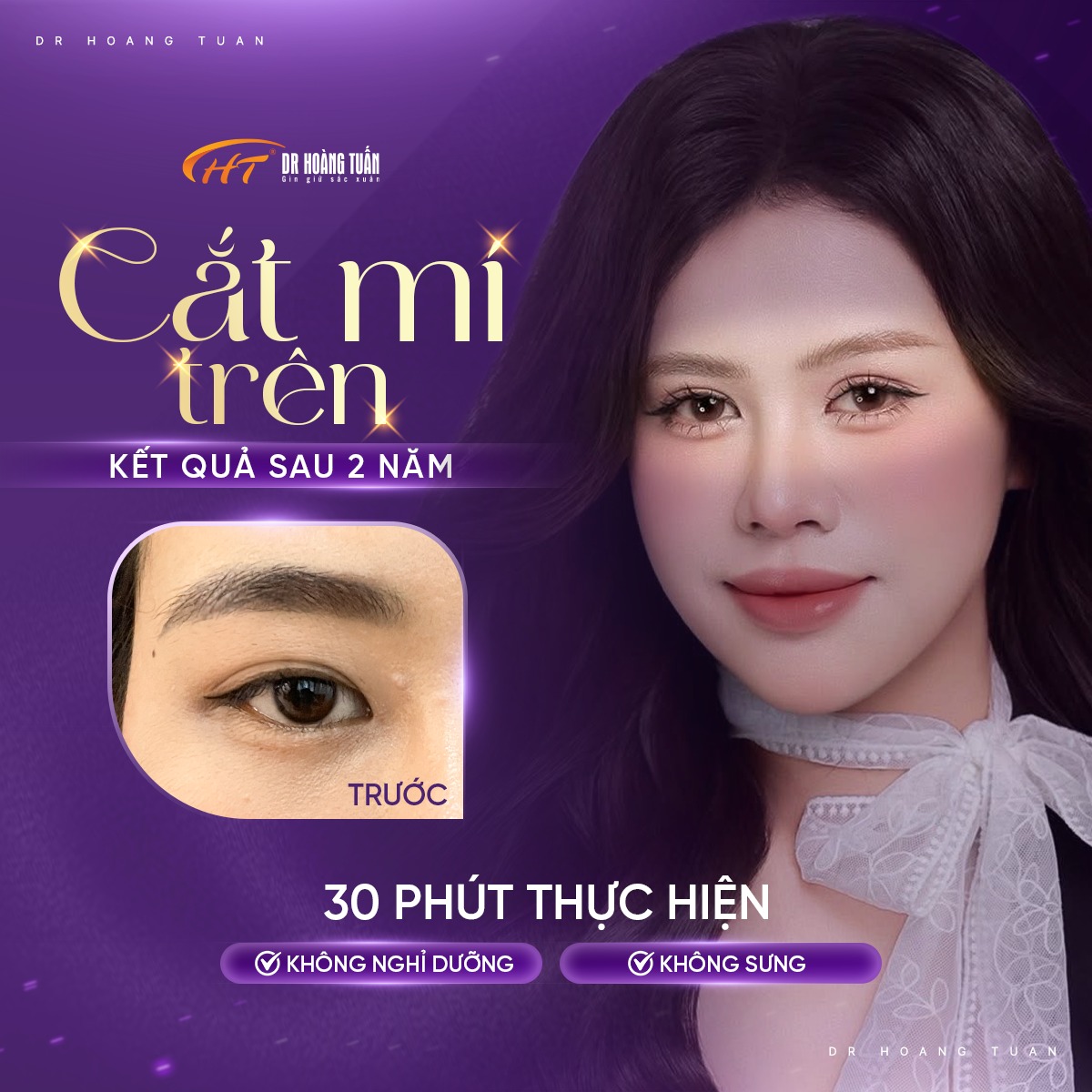 cắt m&iacute; l&agrave;m sao cho nhanh hết sưng