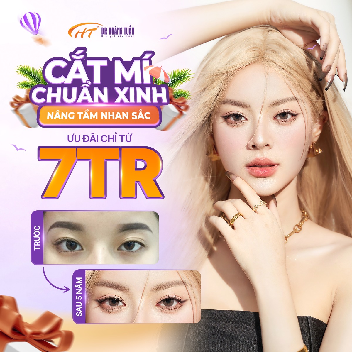 cắt mí hết bao tiền