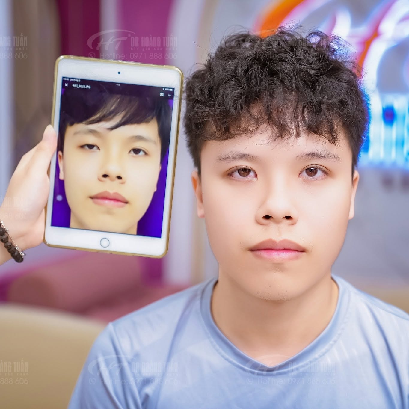 cắt m&iacute; mắt nam