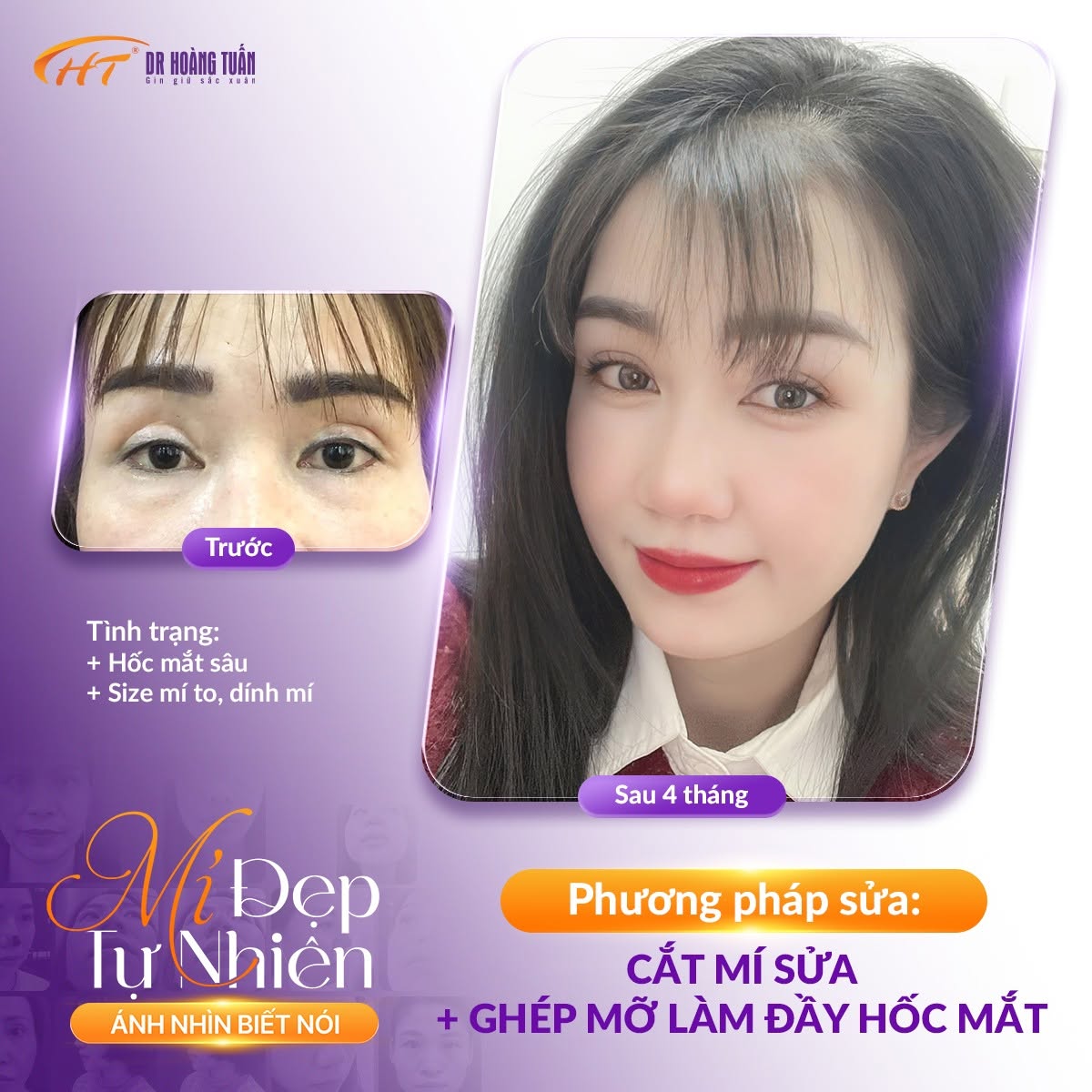cắt m&iacute; qu&aacute; s&acirc;u