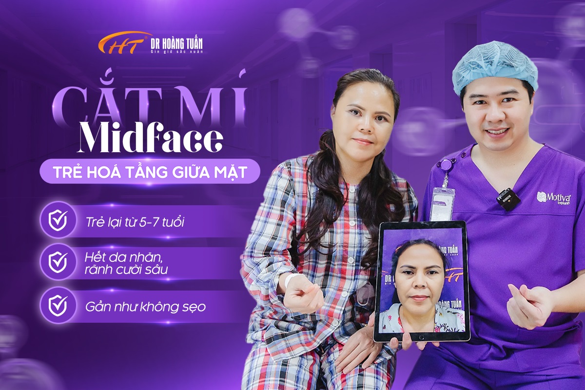 Cắt mí Midface sở hữu nhiều ưu điểm nổi bật mang đến hiệu quả trẻ hóa khác biệt 