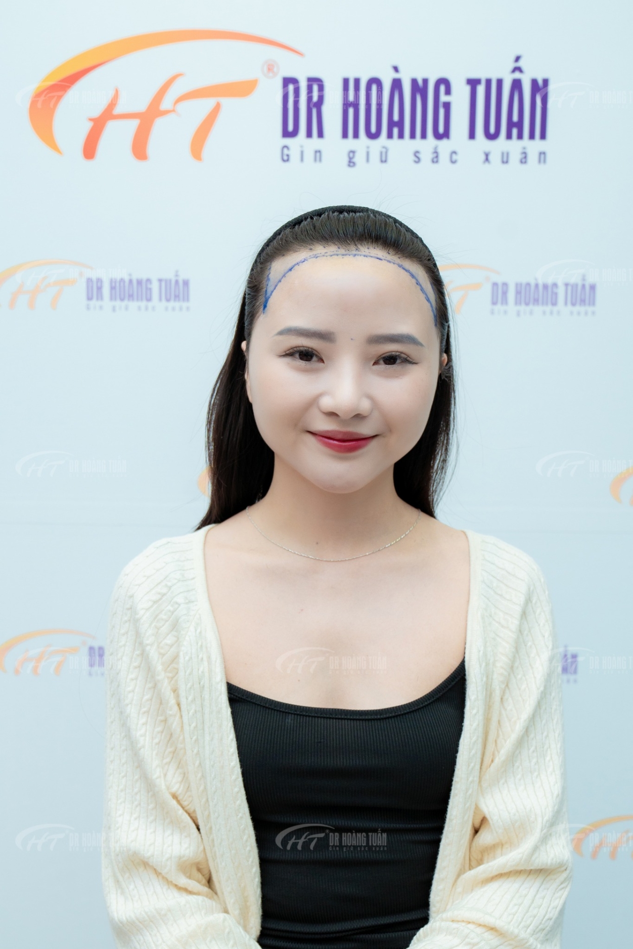 h&oacute;i đầu c&oacute; chữa được kh&ocirc;ng