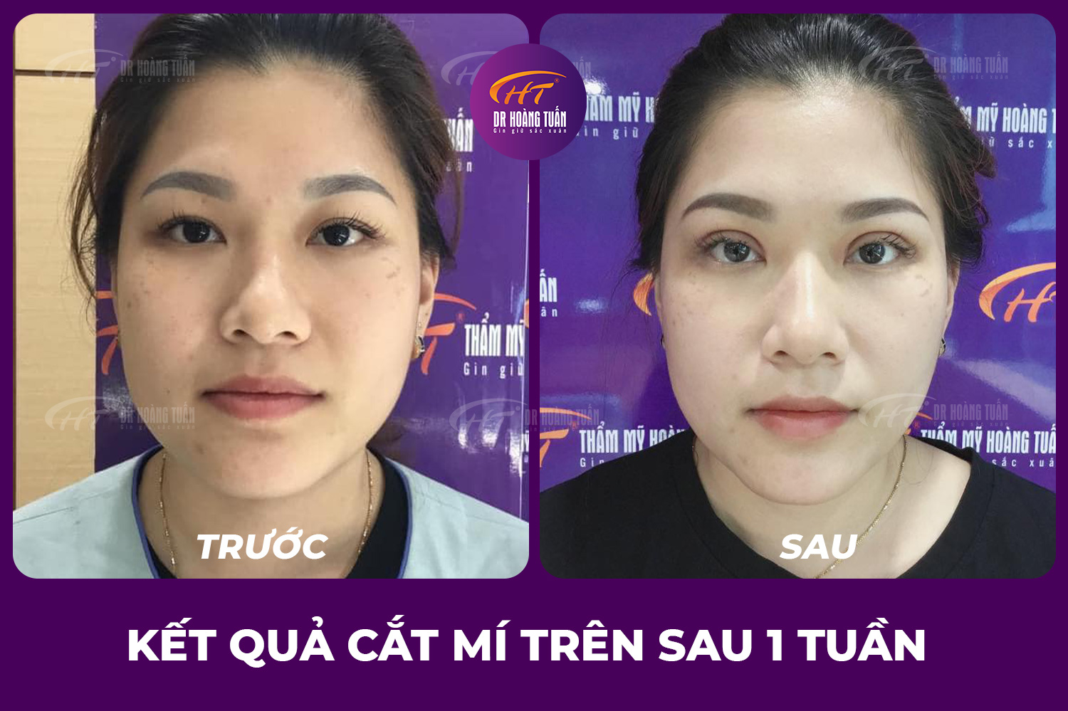 THẨM MỸ HOÀNG TUẤN CHI NHÁNH HÀ NỘI VỚI CƠ SỞ HIỆN ĐẠI