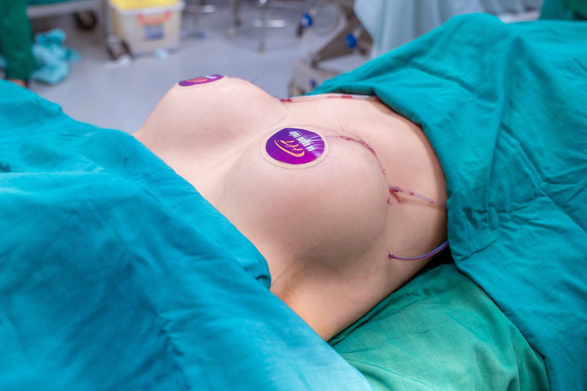 Hình ảnh khách hàng treo sa trễ tại Dr Hoàng Tuấn 