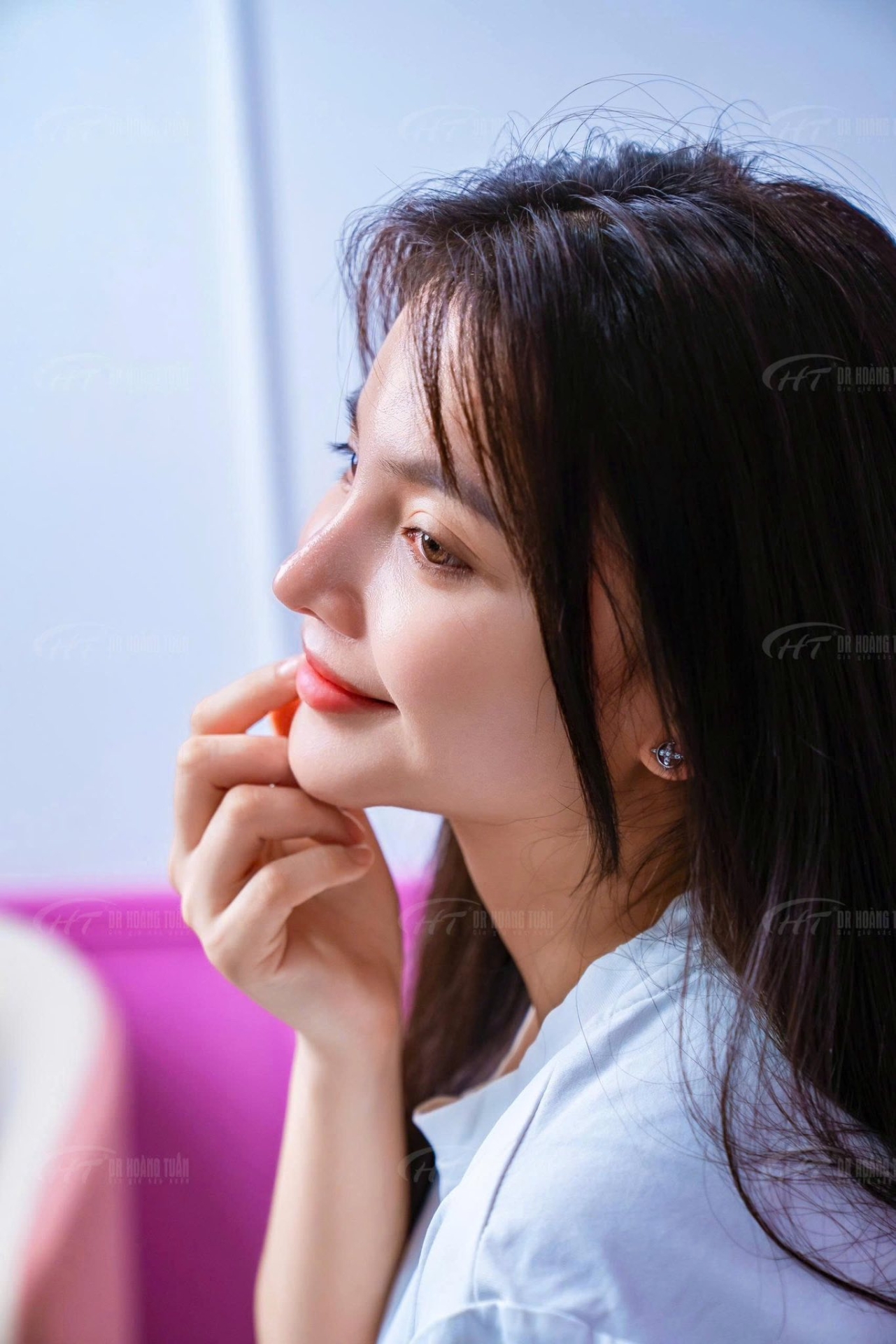 độn cằm bao l&acirc;u th&igrave; đ&aacute;nh răng được
