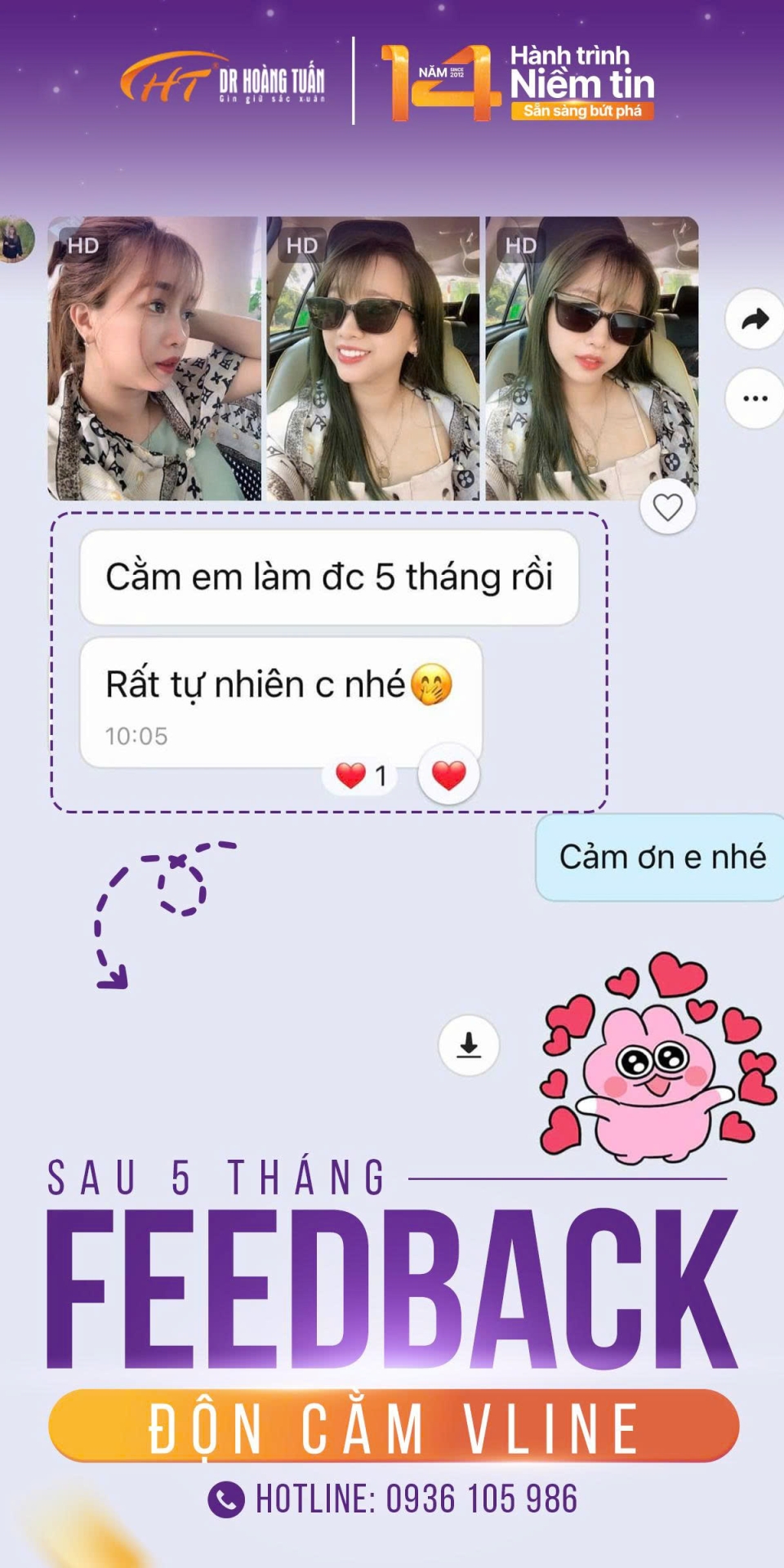 độn cằm
