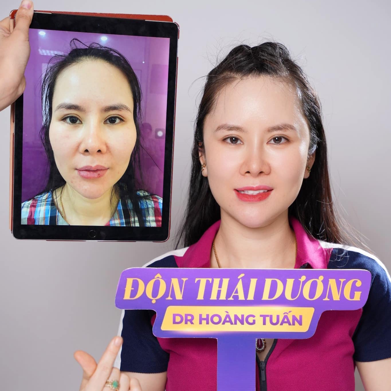 độn th&aacute;i dương được bao l&acirc;u