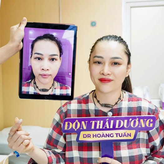 H&igrave;nh ảnh độn th&aacute;i dương trước v&agrave; sau