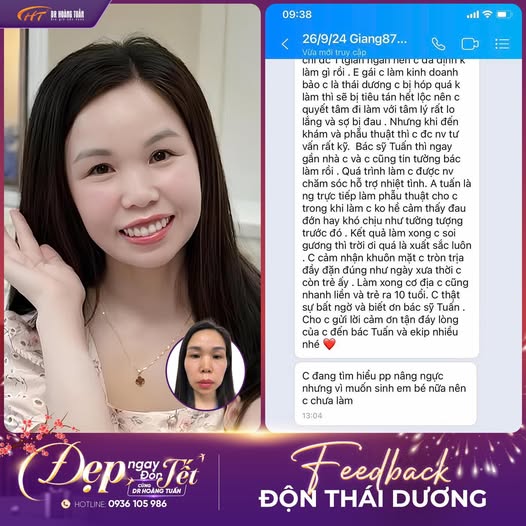 Độn th&aacute;i dương bao l&acirc;u hết sưng