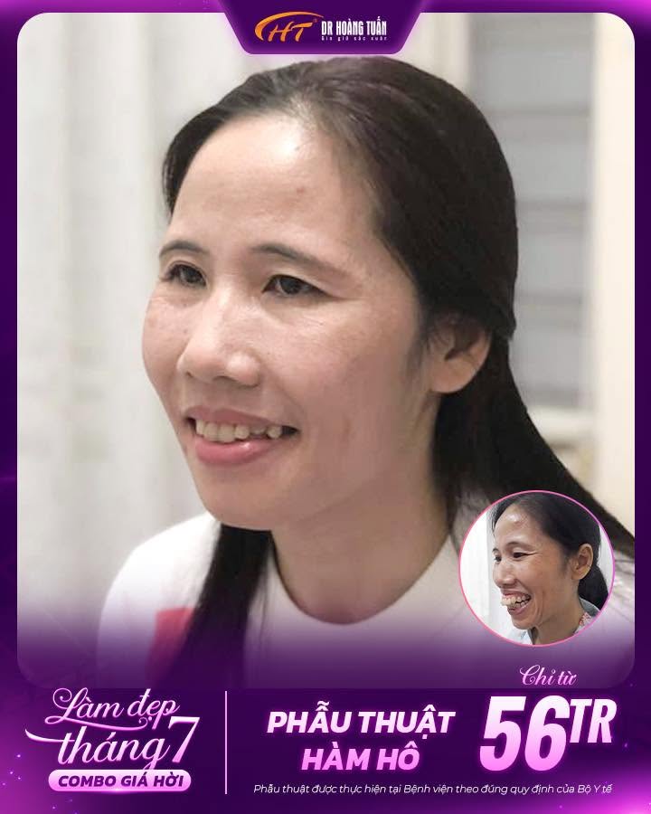 chỉnh h&agrave;m h&ocirc; gi&aacute; bao nhi&ecirc;u