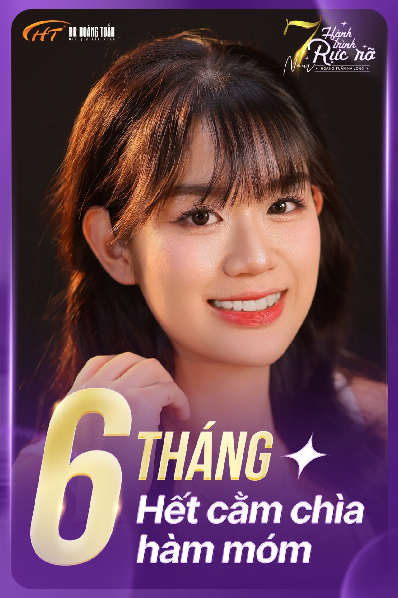 Chỉnh H&agrave;m M&oacute;m
