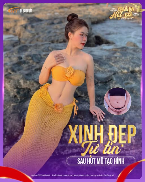 h&uacute;t mỡ tạo h&igrave;nh bụng gi&aacute; bao nhi&ecirc;u