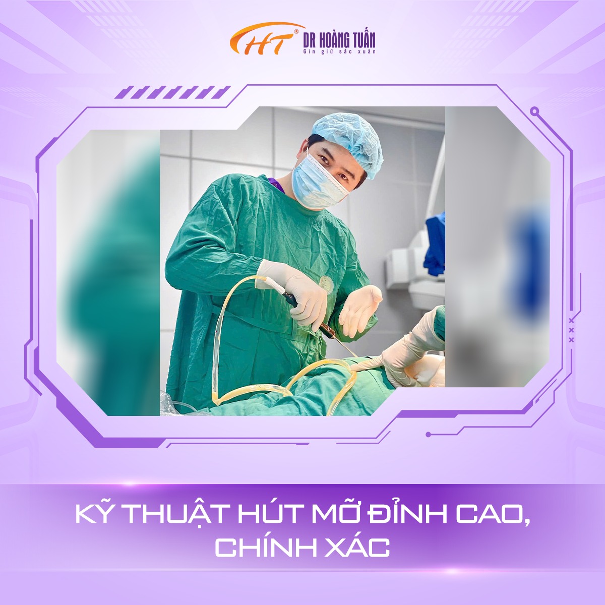 phẫu thuật hút mỡ đùi gây tê hay gây mê