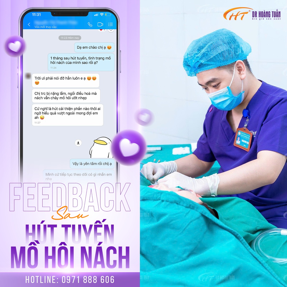 h&uacute;t tuyến mồ h&ocirc;i n&aacute;ch gi&aacute; bao nhi&ecirc;u tiền