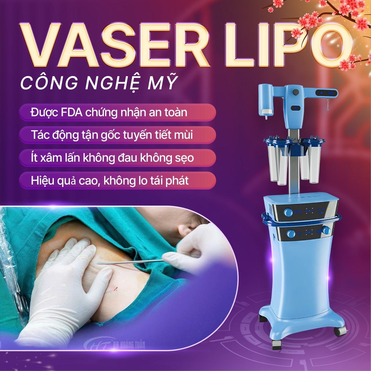 h&uacute;t tuyến mồ h&ocirc;i n&aacute;ch c&oacute; hết kh&ocirc;ng