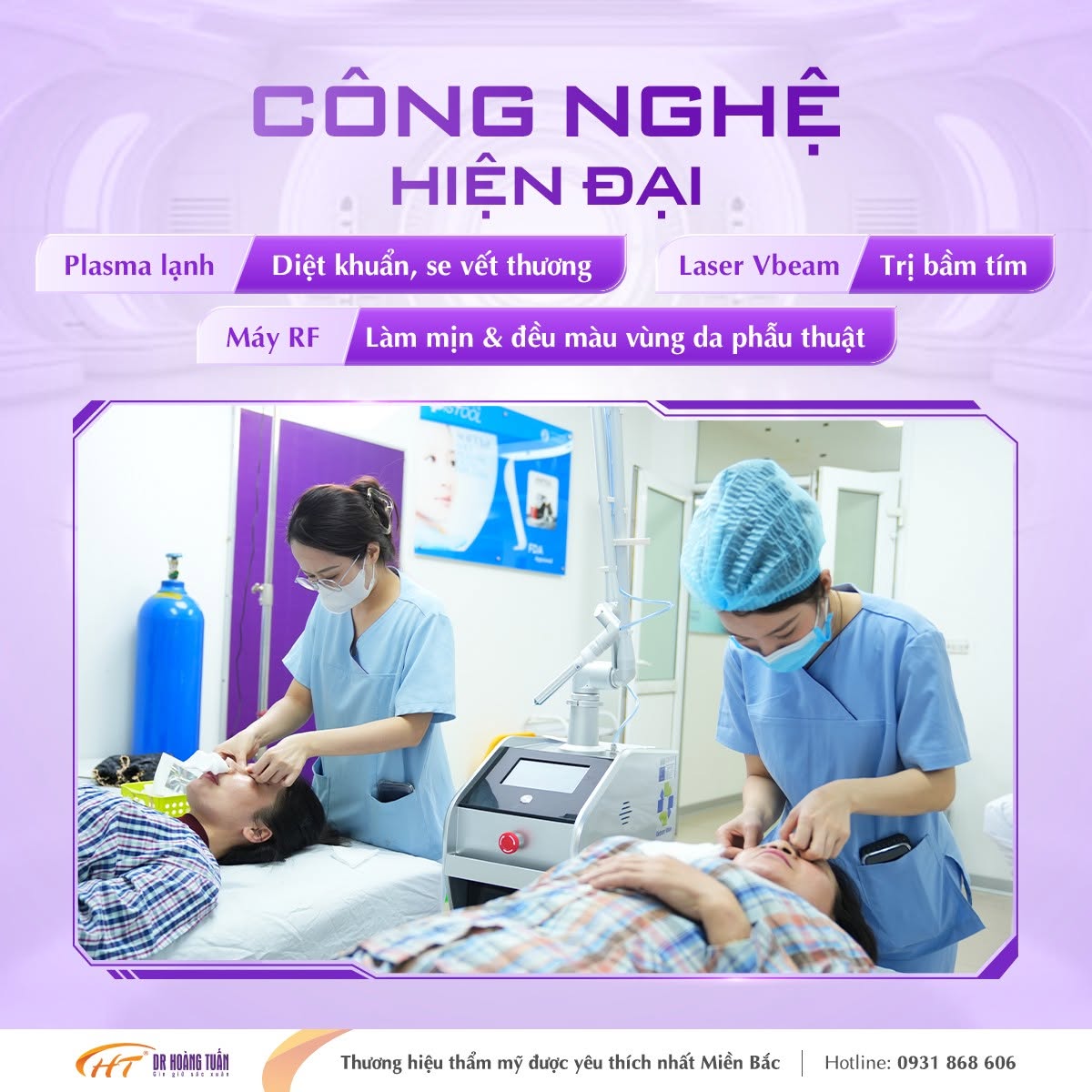 mở góc mắt ở đâu đẹp
