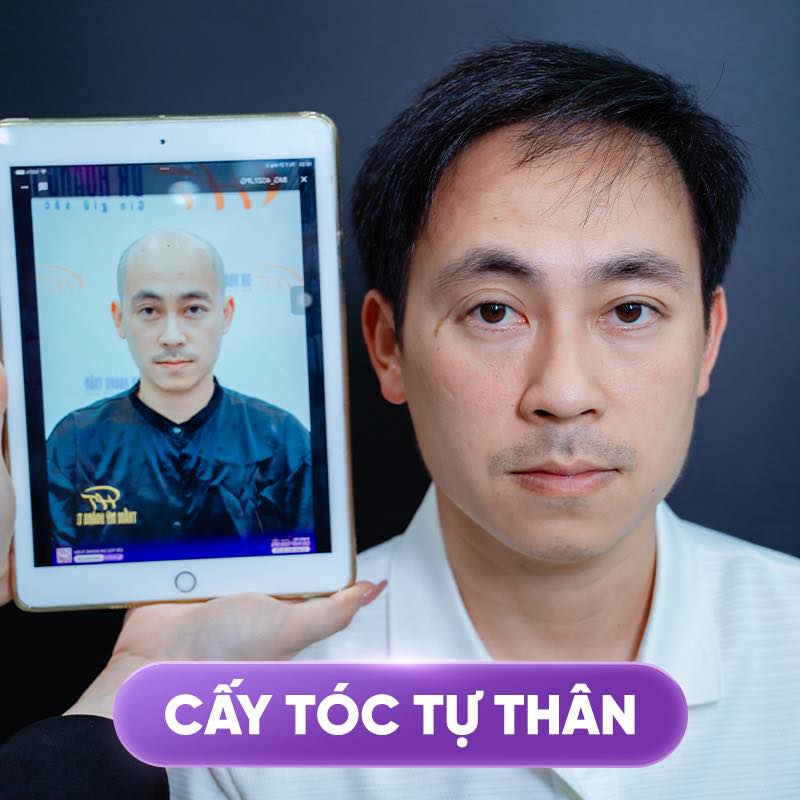 h&oacute;i chữ m nam
