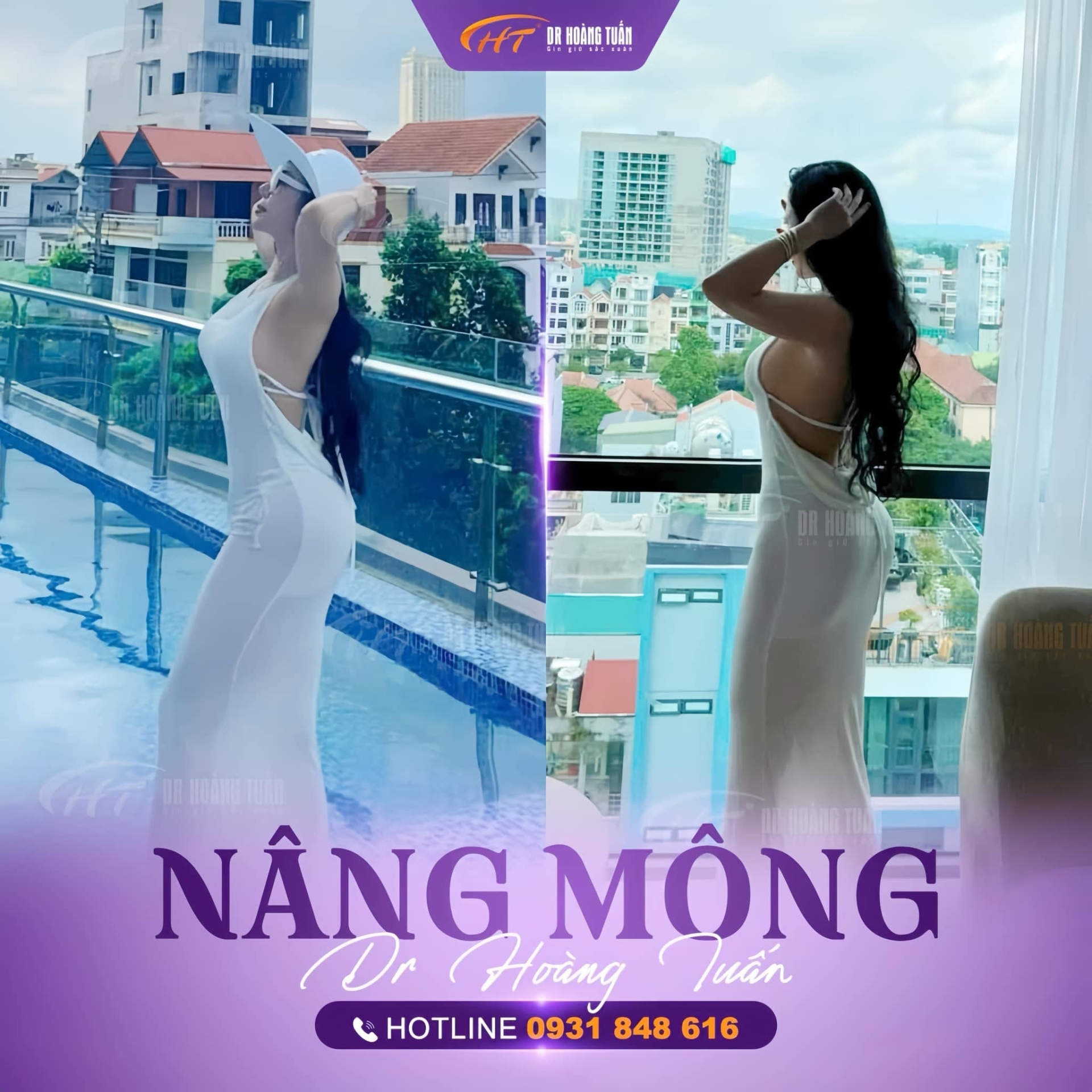 Nâng mông có đau không