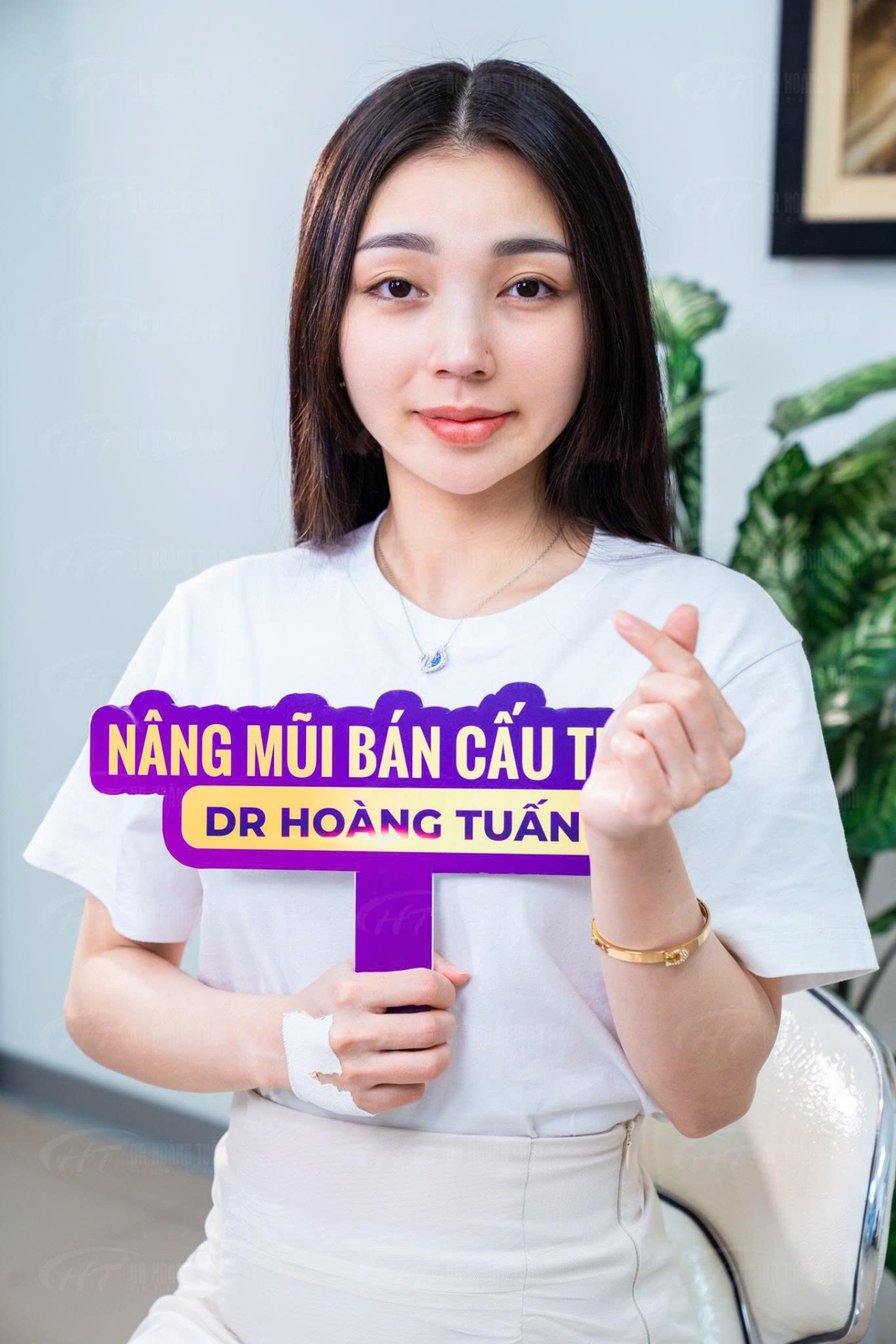 n&acirc;ng mũi bằng chỉ c&oacute; an to&agrave;n kh&ocirc;ng