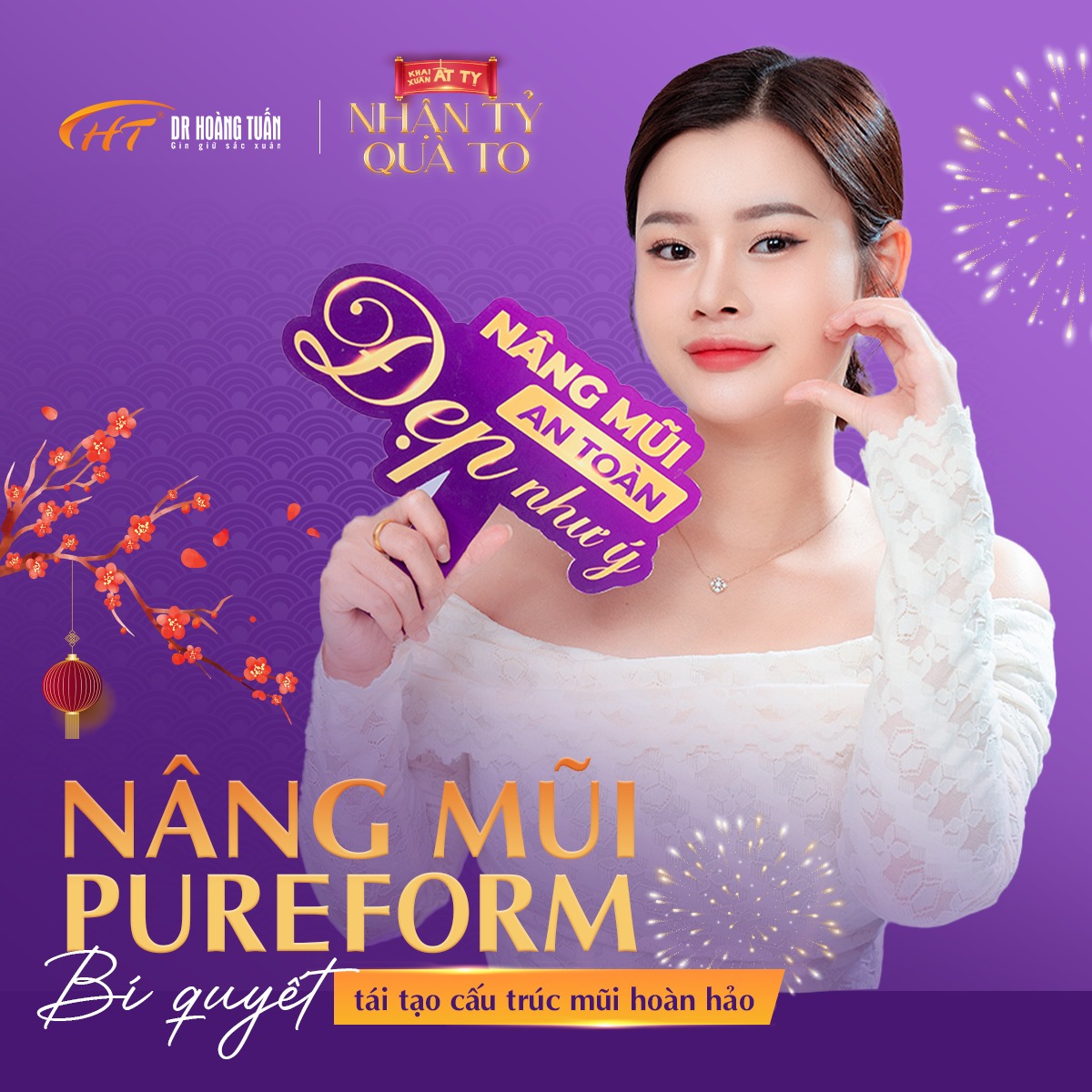 nâng mũi cấu trúc