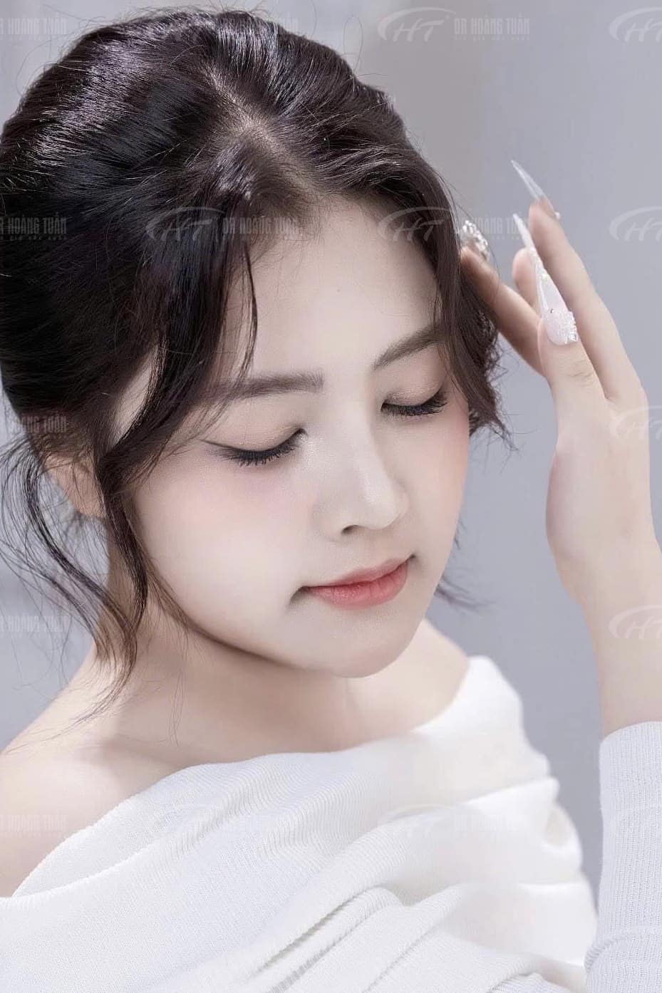 viêm xoang có nâng mũi được không