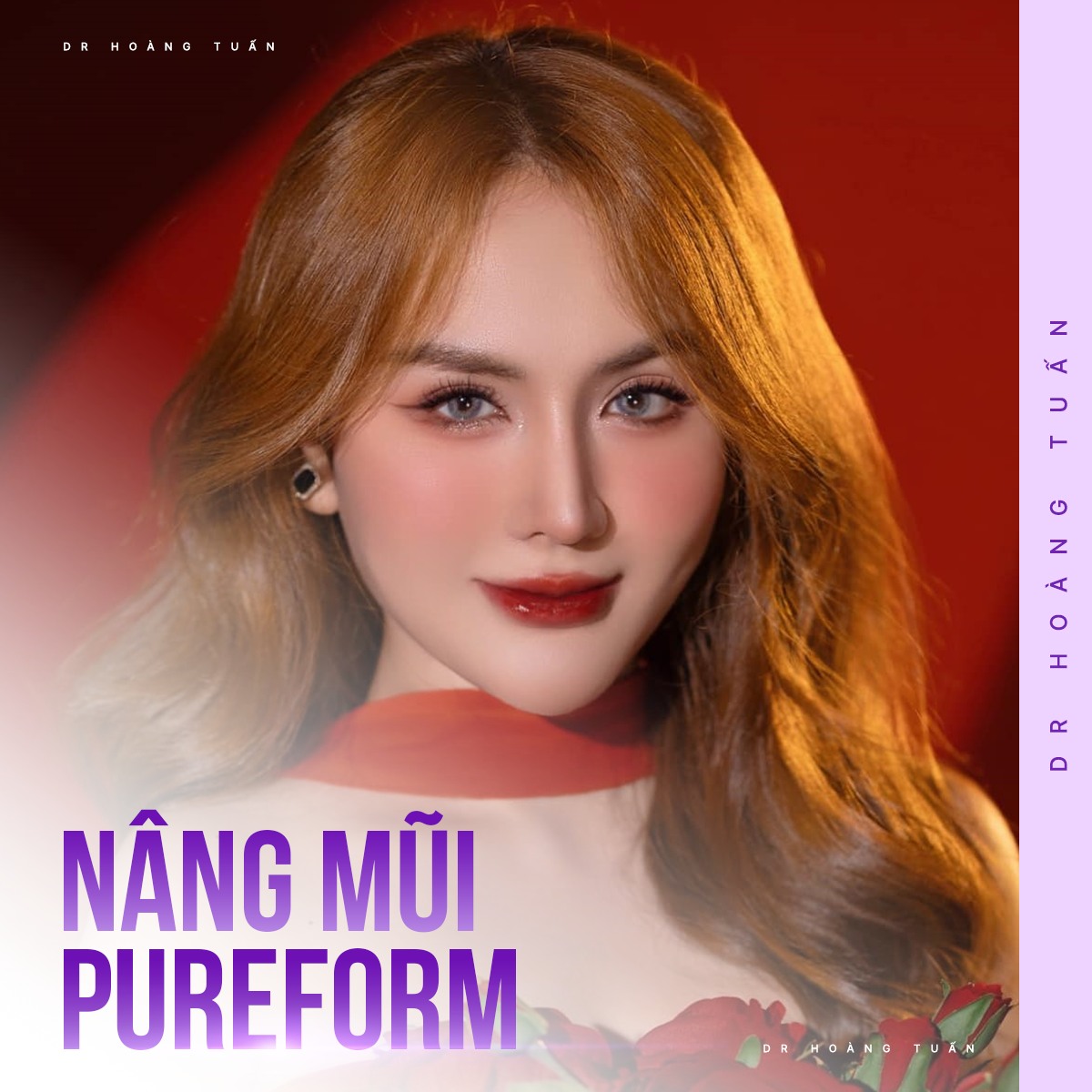 nâng mũi bao lâu thì sinh hoạt bình thường